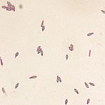 De bacterien Clostridium botulinum 